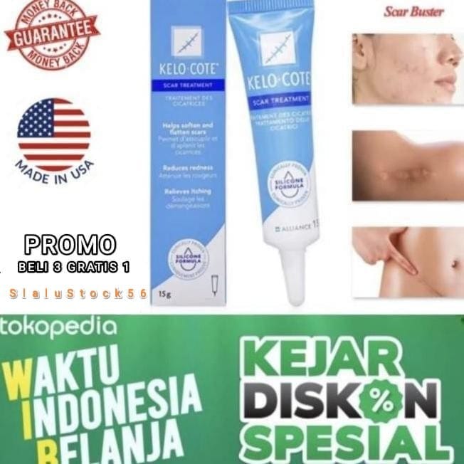 ( Original) Kelo Cote Kelocote Acne Wound Keloid Surgery Import USA ...